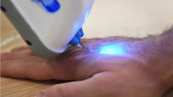 “مستشعر روسي مبتكر لمراقبة مستويات الغلوكوز دون ثقب الجلد”