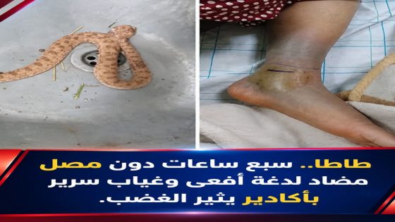 طاطا.. غياب المصل المضاد للدغات الأفاعي يضع حياة المواطنين على المحك